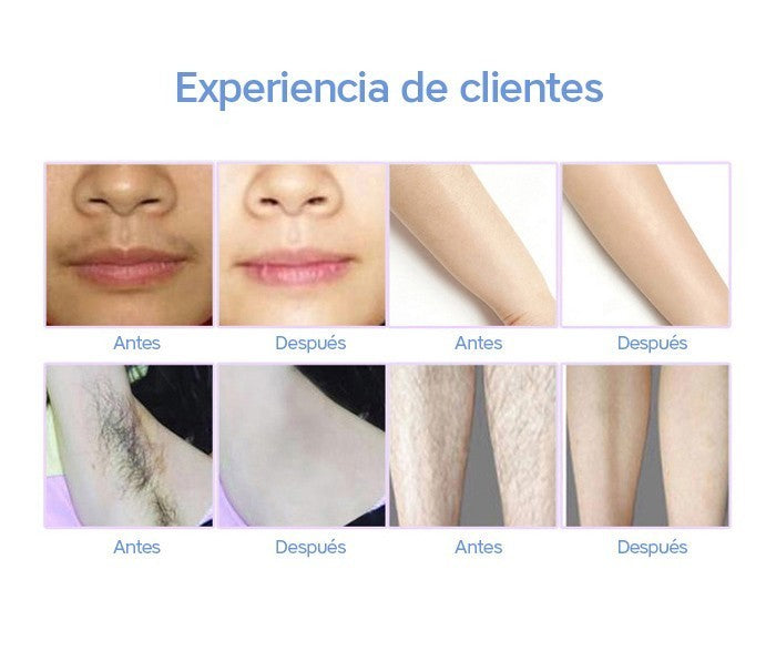 Lescolton 2in1 de depilación láser IPL máquina depiladora láser depilación permanente Bikini Trimmer eléctrico depilador un láser