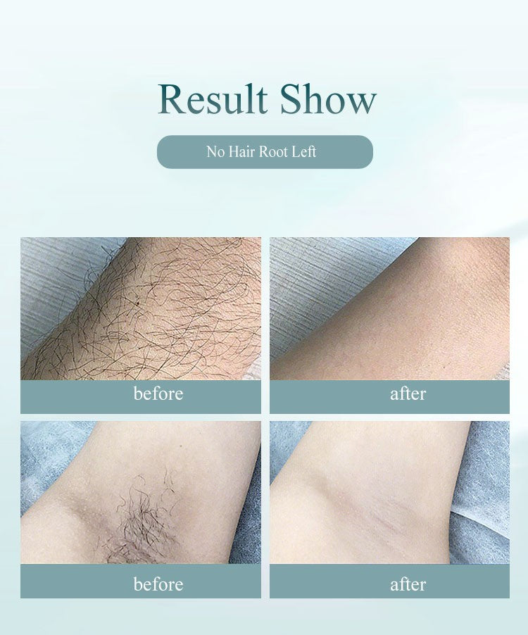 Profesional láser Facial cuerpo Bikini depilación Ipl depiladora femenina indolora luz pulsada mujeres pierna dispositivo depilatorio herramienta