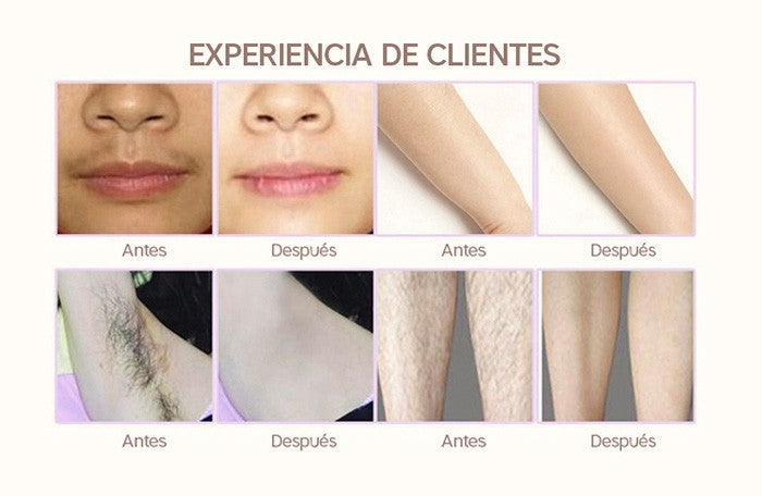 Lescolton 2in1 IPL depiladora cabello pantalla LCD máquina T009i láser permanente Bikini Trimmer eléctrico depilador un láser
